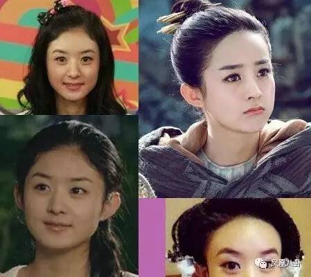 不忍直视杨幂的发际线都快秃到后脑勺了